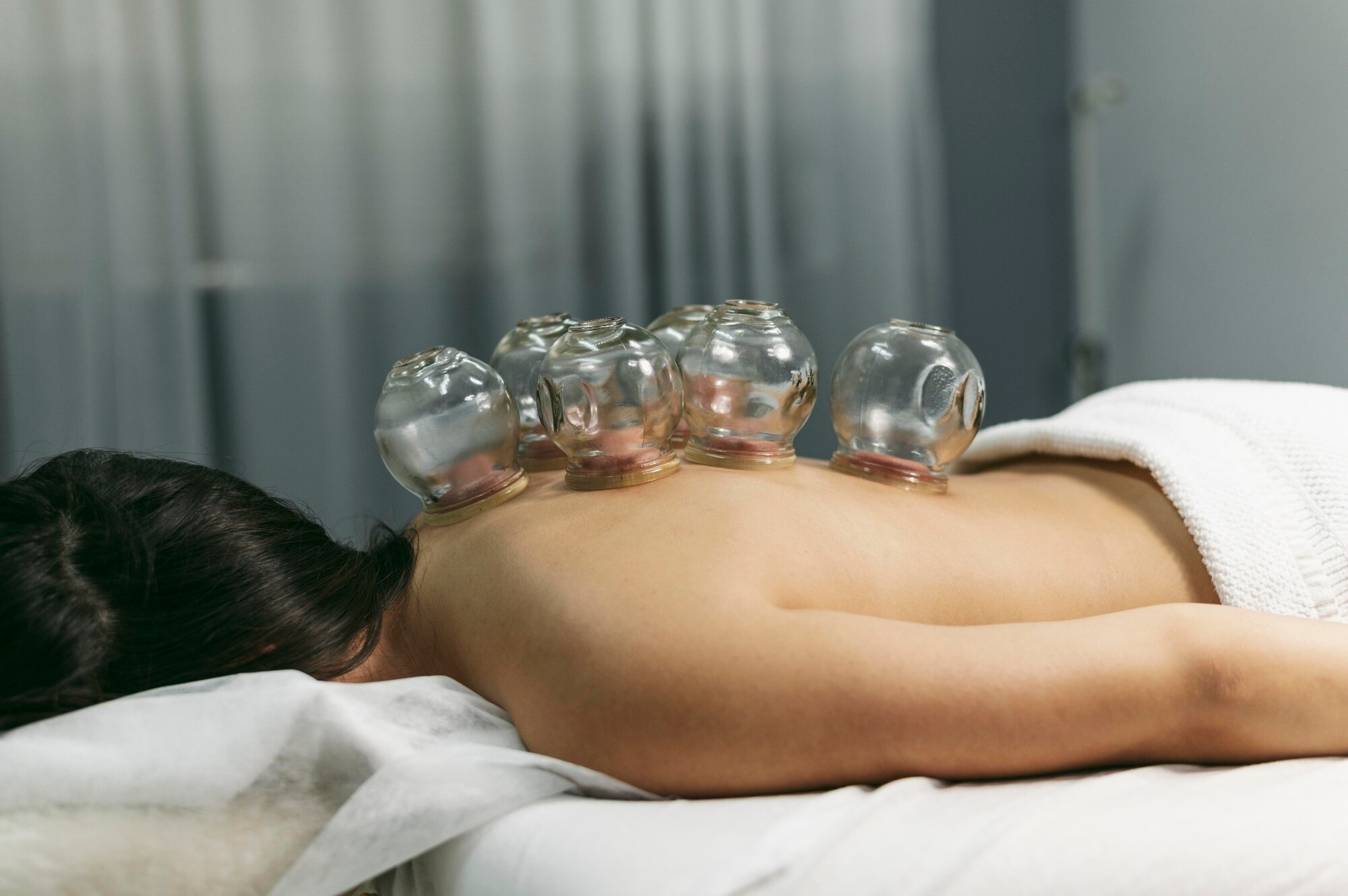 What is chinese cupping therapy<br />
