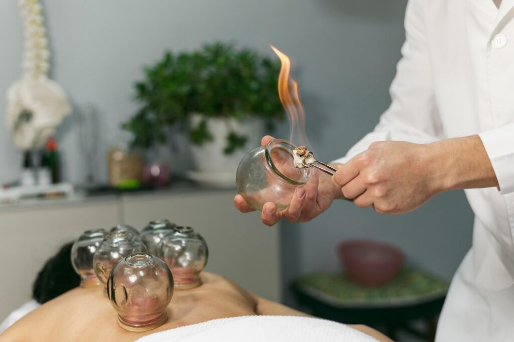 Cupping for beauty and skin health