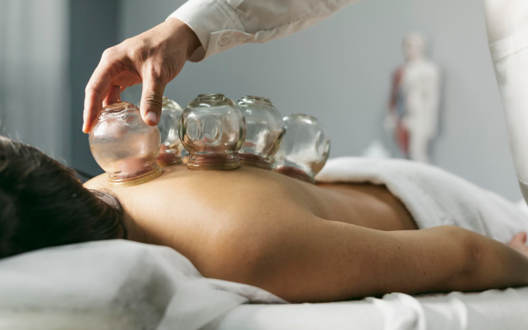 Innovative applications of chinese cupping – from traditional medicine to modern wellness trends