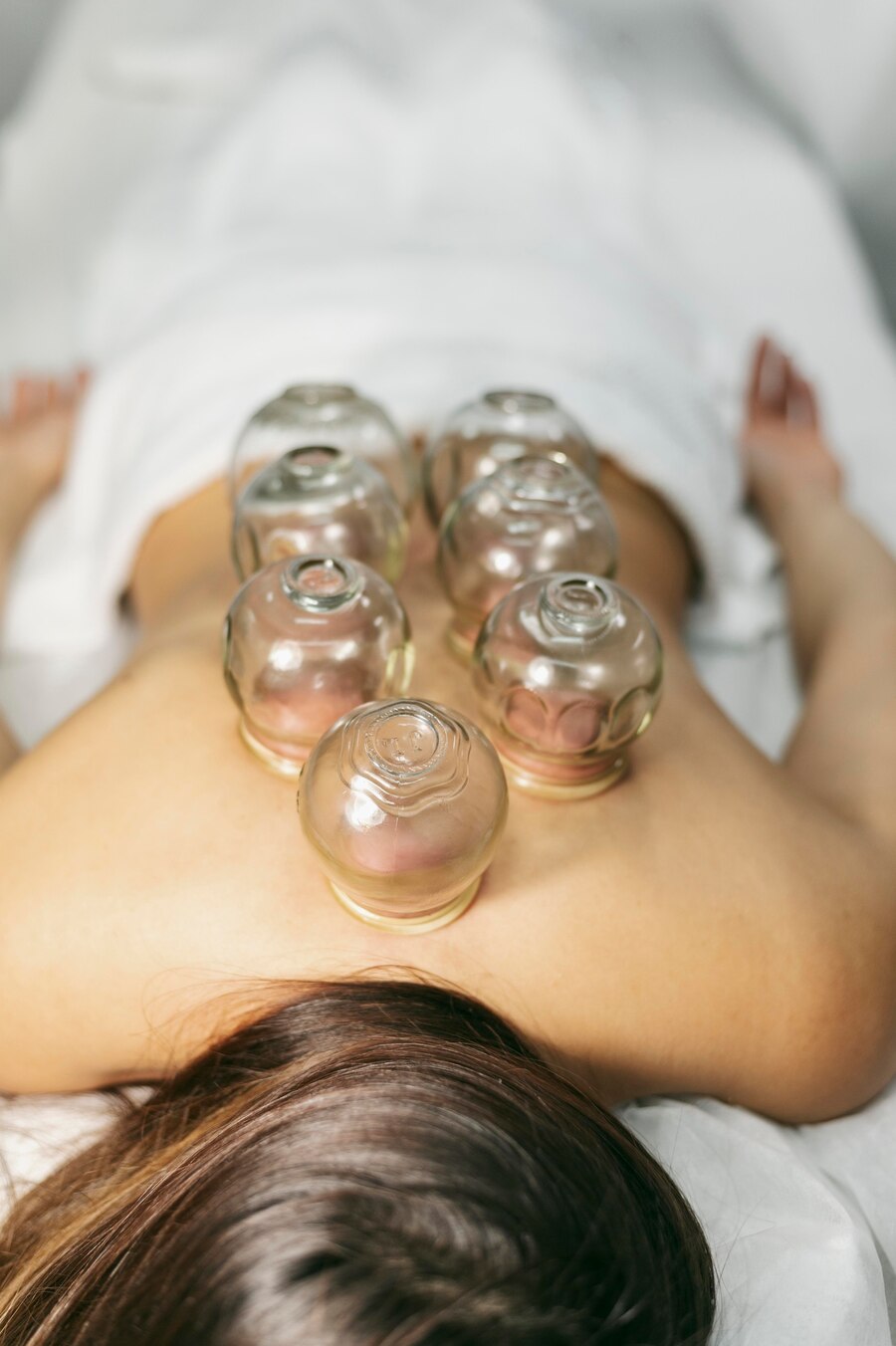 The resurgence of cupping in modern wellness trends<br />
