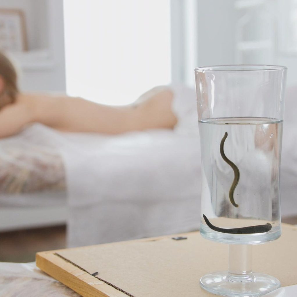 leech therapy